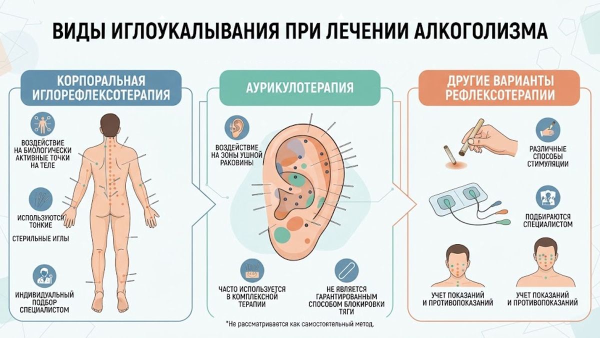Инфографика: виды иглоукалывания при лечении алкоголизма (корпоральная иглорефлексотерапия, аурикулотерапия и другие методы).